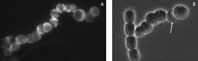 Comparison of WT and mutant filaments of N. punctiforme.