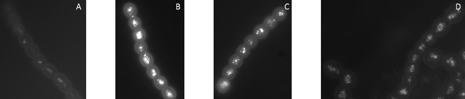 [A], [B], [C] BODIPY-stained filaments of N. punctiforme over-expressing a protein of interest. Notice the size, aggregation, and positioning of the neutral lipids. Proteins are over-expressed by cloning the genes encoding them into a high-copy plasmid which yields around a 100-fold increase in protein expression. [D] WT N. punctiforme stained with BODIPY