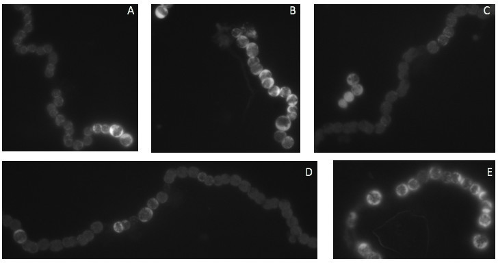 [A], [B], [C], [D], [E] Various filaments of N. punctiforme expressing a translational reporter plasmid fusing a gene of interest to the gene encoding cerulean fluorescent protein (CFP). Nearly all filaments expressing this protein chimera show compromised cell-cell contacts and polar localization of the protein.